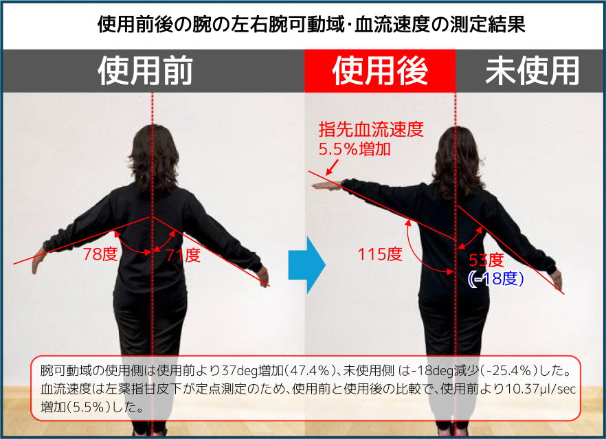 使用前後の腕の左右腕可動域・血流速度の測定結果