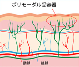 ポリモーダル受容器